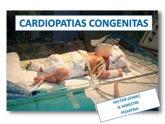 cardiopatias congenitas en pediatria